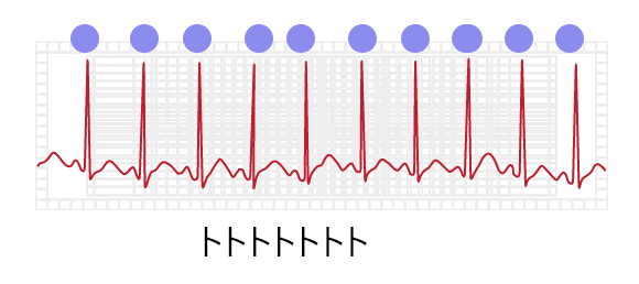 速い音のイメージ