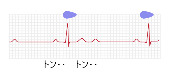 遅い音のイメージ